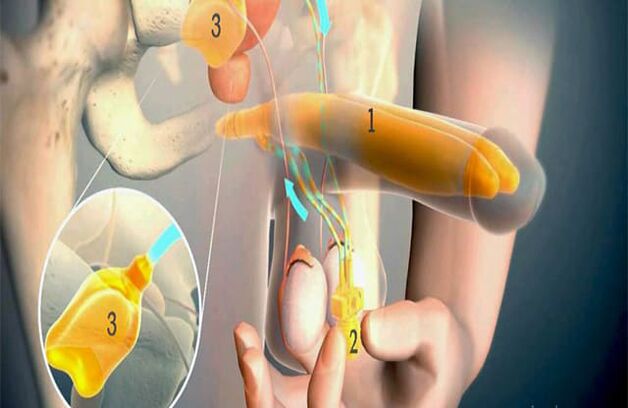 Opération de lipofilling